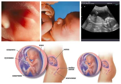 19-я неделя беременности, вес ребенка, фото, календарь беремености |  Мамоведия - о здоровье и развитии ребенка