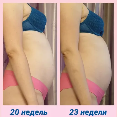 23 недели🎀 Фото животика — 4 ответов | форум Babyblog