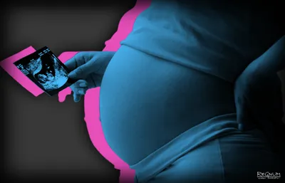Сети США о запрете абортов: «Женщины официально превращаются в секс-рабынь»  - Ксаверий де Местр - ИА REGNUM