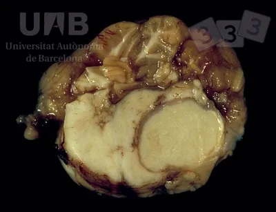 Абсцесс головного мозга - Атлас патологий свиней - pig333.ru, от фермы к  рынку