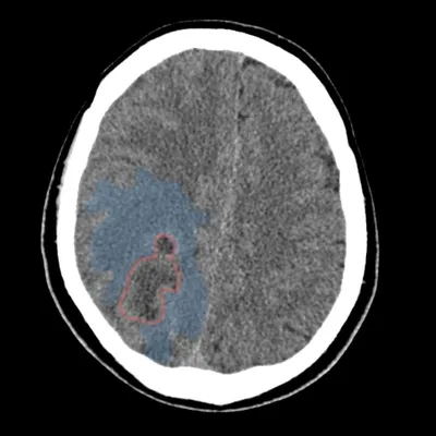 КТ головного мозга (системный подход)