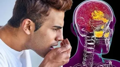 Плохая гигиена полости рта может привести к потенциально смертельным  абсцессам головного мозга - новое исследование
