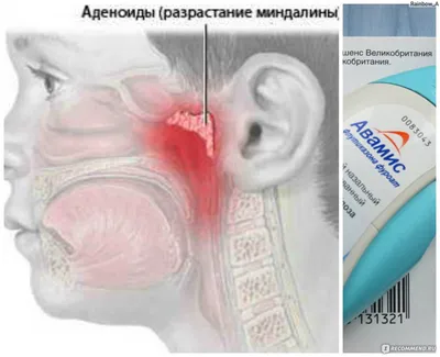 Спрей назальный GlaxoSmithKline Авамис - «Авамис: уменьшаем аденоиды у  ребенка, пытаемся лечить вазомоторный ринит у взрослого. Авамис VS  Назонекс, стоит ли экономить? » | отзывы