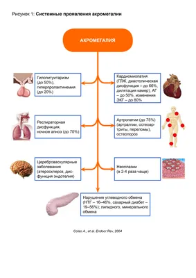Акромегалия: клинические рекомендации, протоколы лечения » Энцикломедия