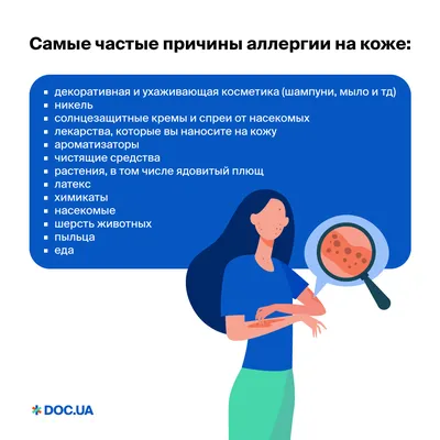 Аллергия на коже: мазь от аллергии на коже, таблетки - аллергия на коже  лечение | Doc.ua