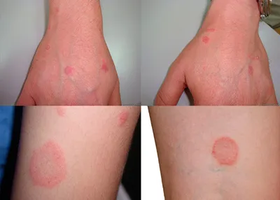 Аллергия на коже: красные пятна чешутся, лечение, фото - Авито - Абхазия
