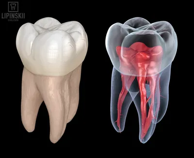 Эндодонтия — лечение каналов - стоимость услуги Наши услуги в Киеве,  Эндодонтия — лечение каналов - цена в стоматологии lipinskii.com.ua