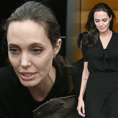 Анджелина Джоли при смерти - KP.RU