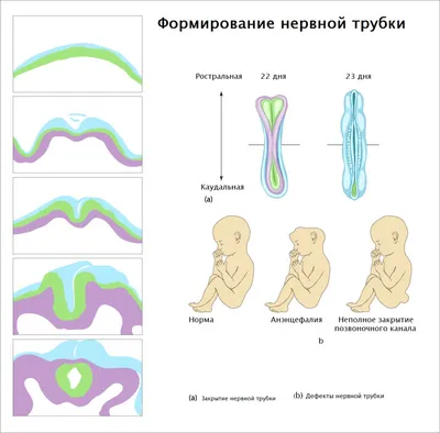 Анемия железодефицитная: симптомы, лечение, степени тяжести, причины,  классификация и диагностика малокровия