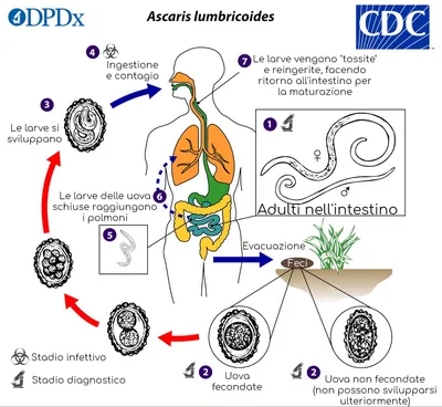 Аскариды у человека: заражение, симптомы, опасность и лечение - Блог  компании INFECTEX