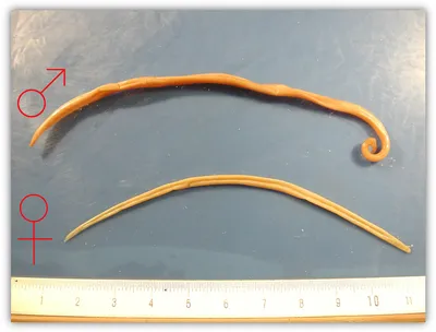 Аскарида человеческая - Ascaris lumbricoides Diagram | Quizlet