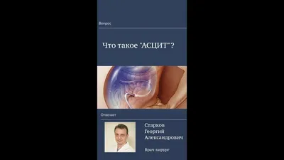 Асцит (водянка брюшной полости) - лечение, симптомы, откачивание жидкости