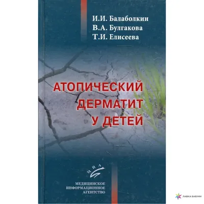 Атопический дерматит у детей, Иван Иванович Балаболкин, Медицинское  информационное агентство купить книгу 978-5-907098-00-8 – Лавка Бабуин,  Киев, Украина