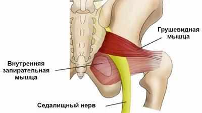 Боль в боковой части бедра: причины, диагностика и лечение - KinesioPro