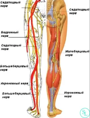 Синдром грушевидной мышцы (Piriformis syndrome, туннельная невропатия  седалищного нерва)