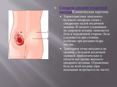 Презентация на тему: Остеоартроз (ОА)