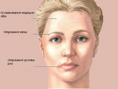 Боремся с носогубными складками. Можно ли их убрать | Женские тонкости |  Дзен