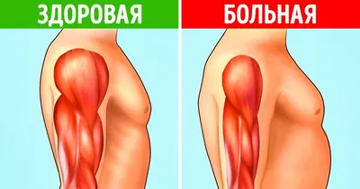 Атрофия лицевых мышц: хирург раскрыл последствия пластических операций Веры  Алентовой