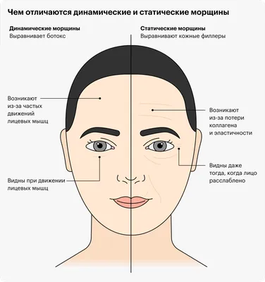 7-932-304-15-03 - ⠀ Если Вы боитесь инъекций ботулотоксина - этот пост для  Вас ➡➡➡ ⠀ Что же чаще всего пугает ☺ ⠀ ❌ «произойдёт атрофия мышц» ⠀ Этого  не произойдёт, так как