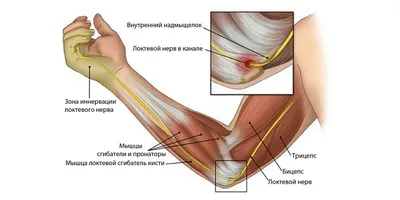 Как защититься от синдрома запястного канала? / Хабр