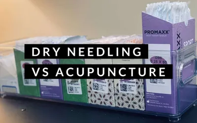 Dry Needling vs Acupuncture - AccessHealth Chiropractic