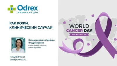 Базалиома кожи: лечение и удаление базальноклеточного рака в Одессе