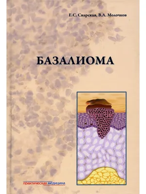 Базалиома Практическая медицина 35618919 купить в интернет-магазине  Wildberries