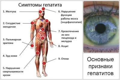 Что такое гепатит?