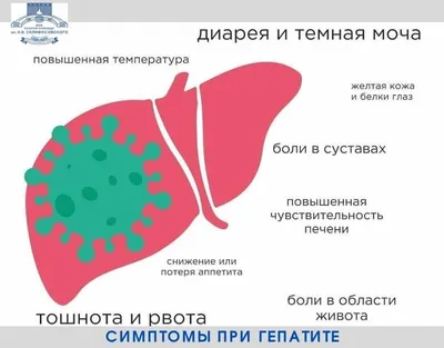 Причины пожелтения глаз и способы их лечения