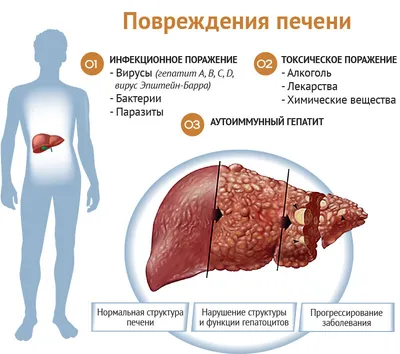 Как убрать покраснение с глаз