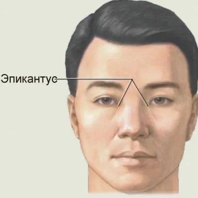 Кератит - причины появления, симптомы заболевания, диагностика и способы  лечения