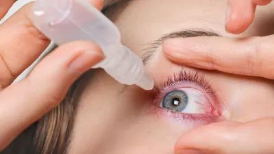 Зудит и режет: как распознать синдром сухого глаза? - новости медицины