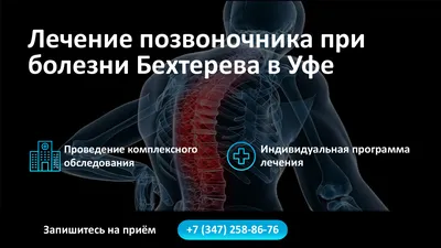 Лечение позвоночника при болезни Бехтерева в Уфе — Аспект Здоровья