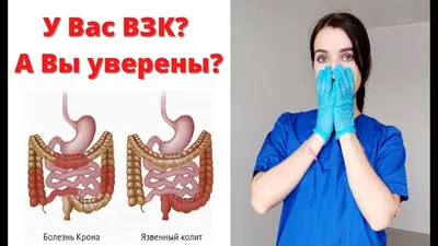 КАК ДИАГНОСТИРОВАТЬ Болезнь КРОНА и ЯЗВЕННЫЙ КОЛИТ ❓ Личный опыт врача -  YouTube