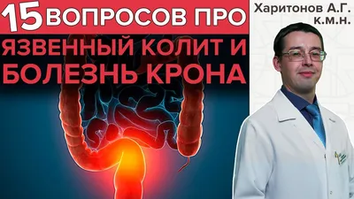 Болезнь крона больных фотографии