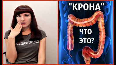 КАК Я ЖИВУ С НЕИЗЛЕЧИМОЙ БОЛЕЗНЬЮ? БОЛЕЗНЬ КРОНА- ЭТО ВАЖНО ЗНАТЬ - YouTube