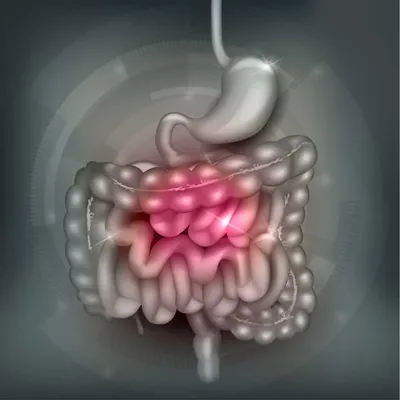 Болезнь Крона | Лечение Болезни Крона в Москве