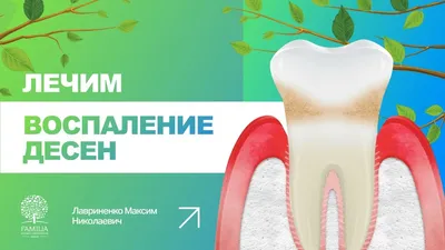 👨\u200d⚕️ Как лечить воспаление десен? - YouTube