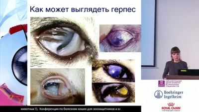 Гунина А. А. - Глазные поражения при герпесвирусной инфекции - YouTube
