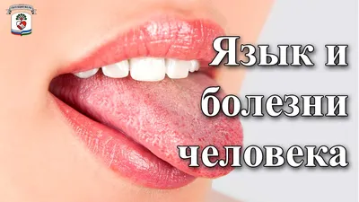 Как распознать болезни по языку: 10 симптомов, которые нельзя игнорировать  | DOCTORPITER