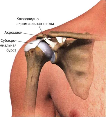 Бурсит плеча — что это такое? Симптомы, лечение и реабилитация