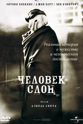 Тайна возрастом 130 лет: в Великобритании нашли вероятную могилу Человека- слона