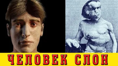 ХОБОТ ВЛАСТИ ТУГОЙ: ЧЕЛОВЕК-СЛОН