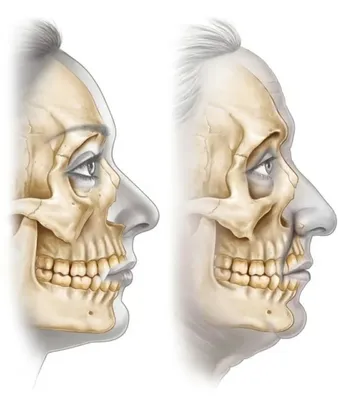 Как стареют кости черепа?