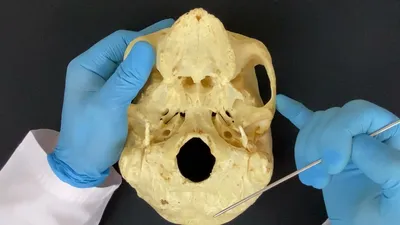Наружное основание черепа - Basis cranii externa (анатомия человека) -  YouTube