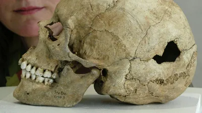 Тайна древних хирургов: зачем наши предки сверлили черепа наживую - РИА  Новости, 22.08.2021