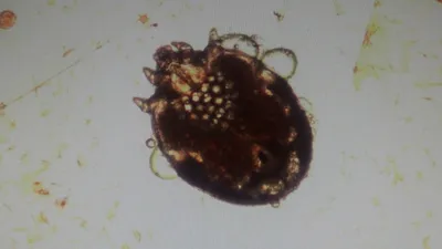Чесоточный КЛЕЩ под микроскопом!!! Itch-mite under a microscope!!! - YouTube
