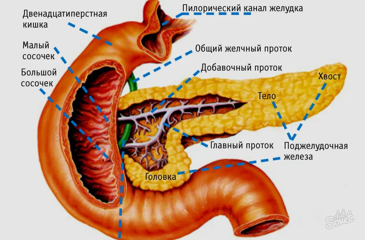 Вирсунгов проток это. Поджелудочная железа препарат анатомия. Протоки поджелудочной железы анатомия. Малый сосочек двенадцатиперстной кишки располагается. Малый проток поджелудочной железы.