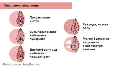 Вагинальный кандидоз молочница - симптомы и лечение - КГБУЗ Горбольница №12