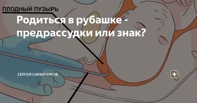 Малыш родился в рубашке что это значит и каковы опасности